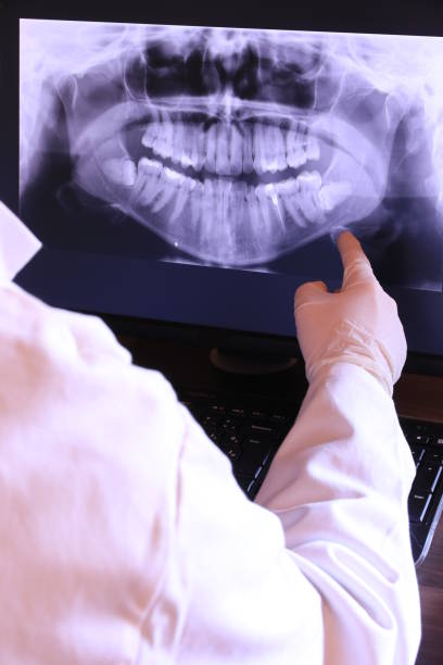 Emergency Dental Filling Replacement in NY