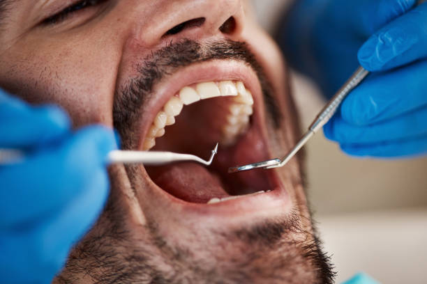 Best Same-Day Dentist Appointment  in Trumansburg, NY